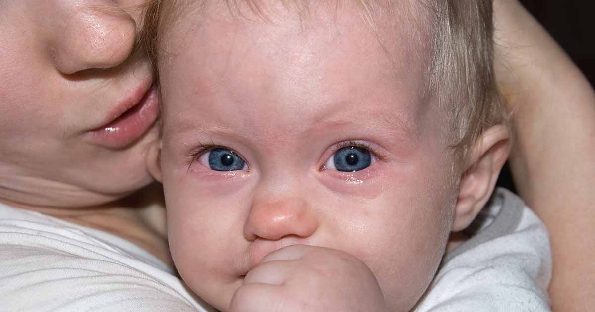 Может ли у ребенка поменяться. Застаивание слезы у новорожденных. У новорожденного застаивается слеза. Застой слезы у новорожденного. Как выглядят слезы у грудничков.